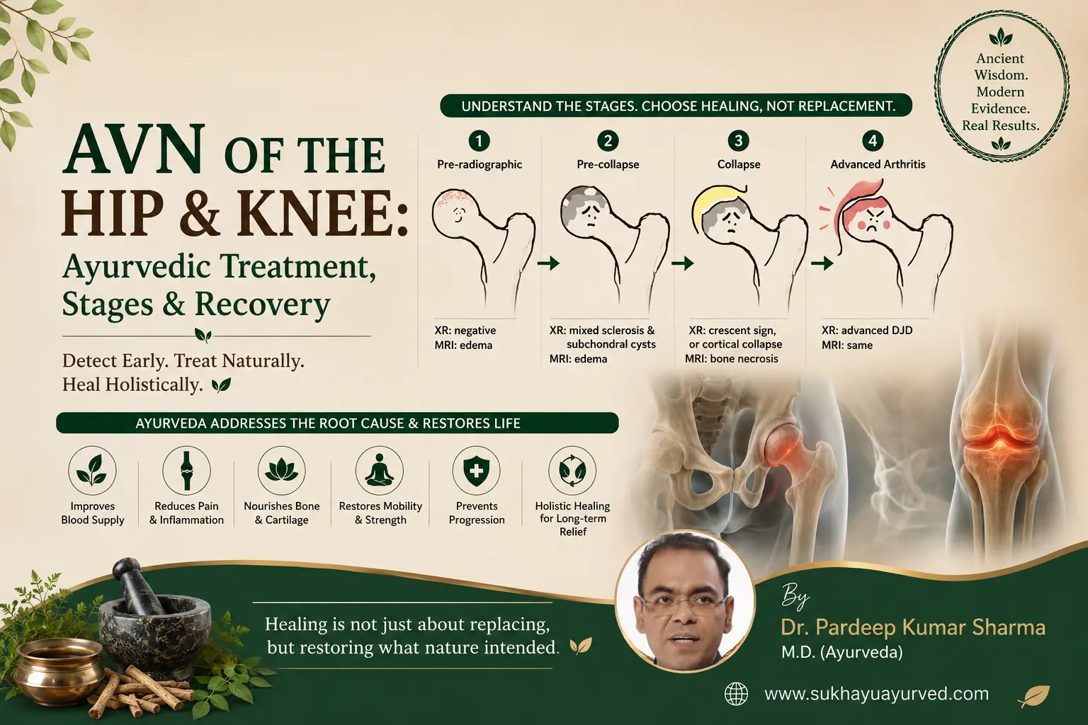AVN of the Hip & Knee: Ayurvedic Treatment, Stages & Recovery