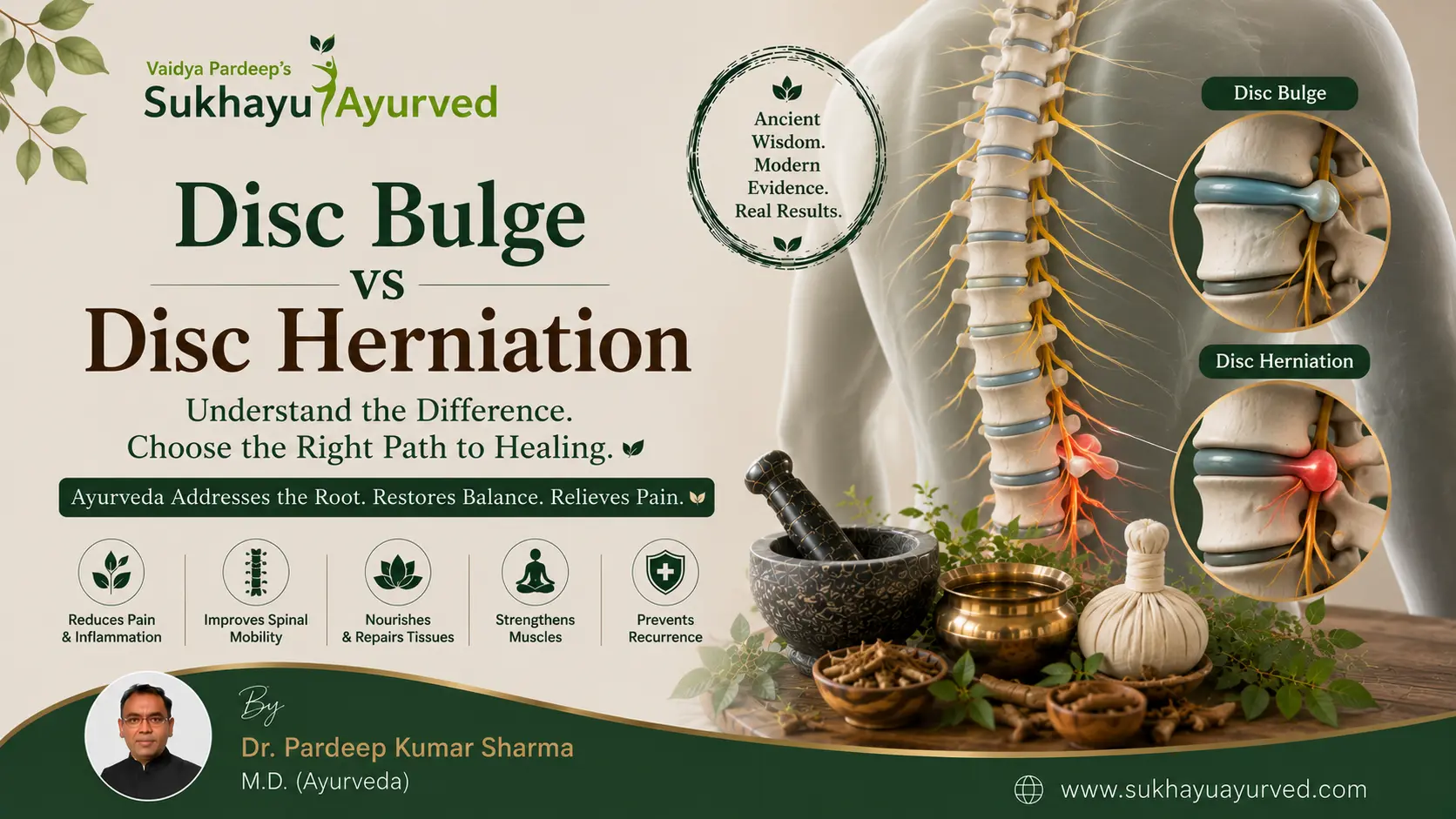 Disc Bulge vs Disc Herniation: What Your MRI Report Is Actually Telling You