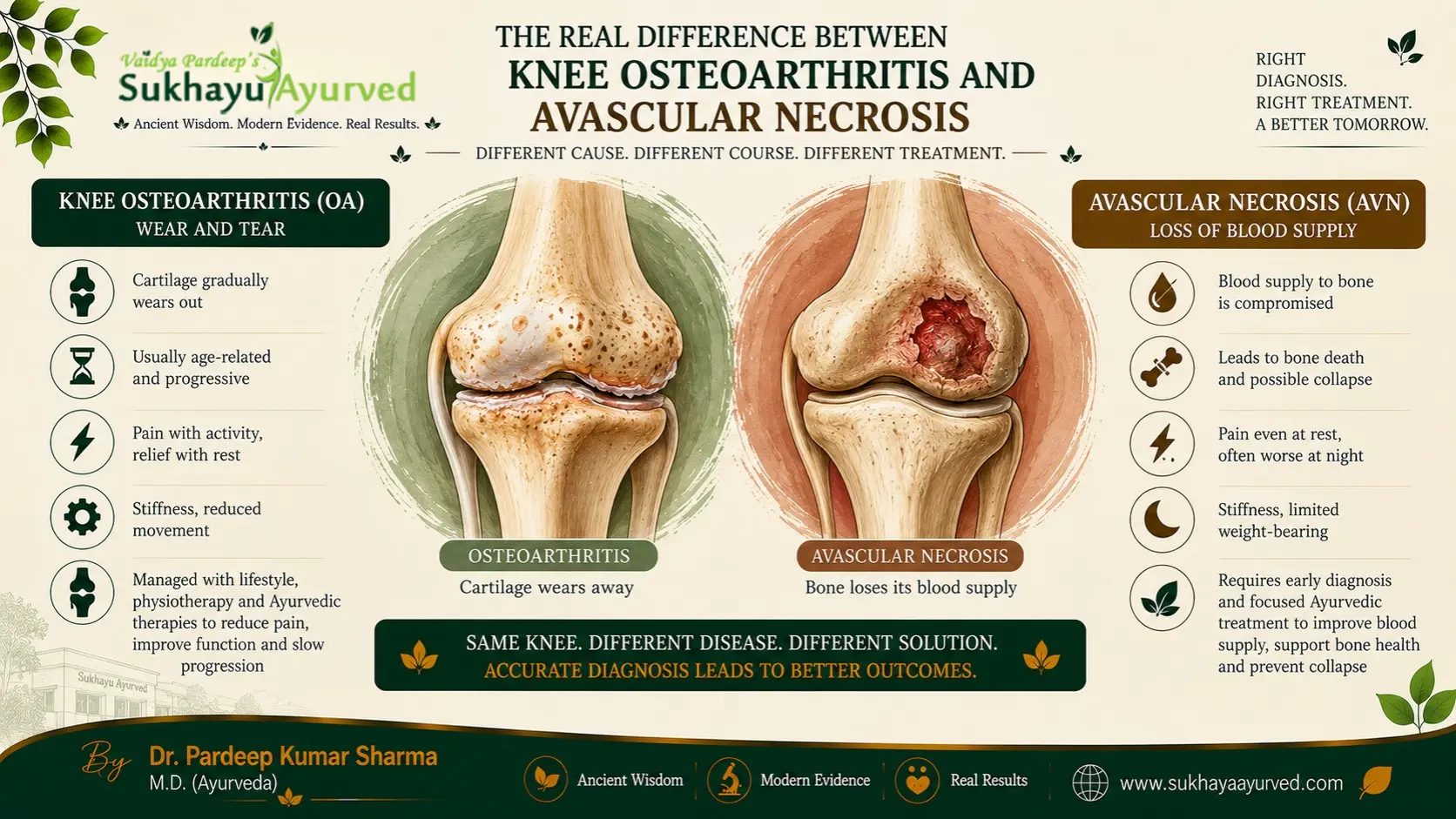 The Real Difference Between Knee Osteoarthritis and Avascular Necrosis